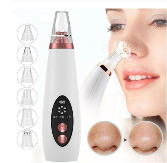 Microcrystalline Blackhead Remover with adjustable suction power for gentle skincare