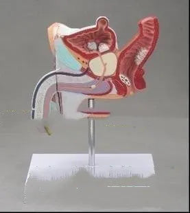 Plastic anatomical model of male reproductive system showing internal diseases on a 25.5x18x15cm base.