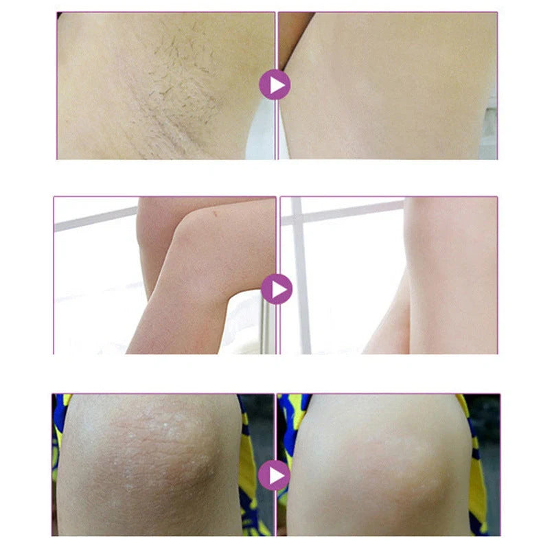 Aichun Armpit Whitening Cream: 50g formula with black pigment repair technology to reduce odour and improve skin tone in the underarm area