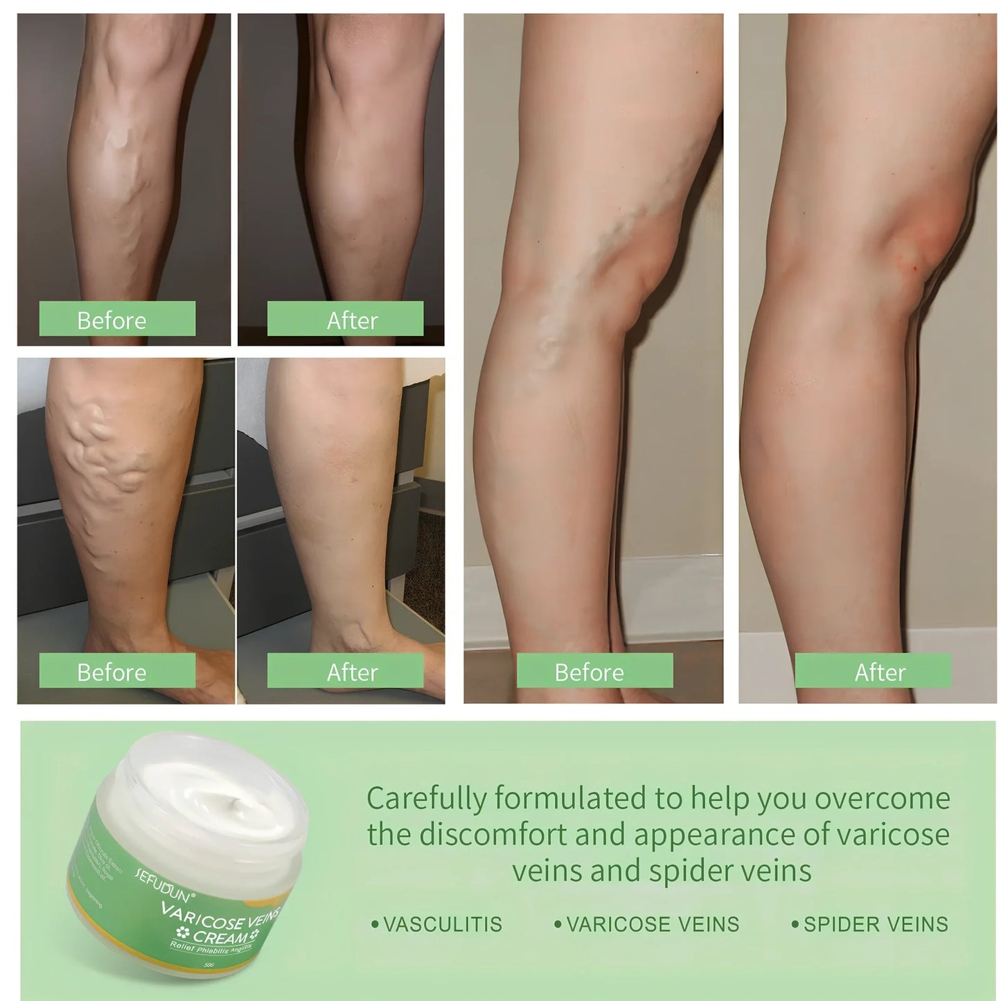50g tube of varicose vein cream with safflower for leg circulation and pain relief, natural ingredients visible on label