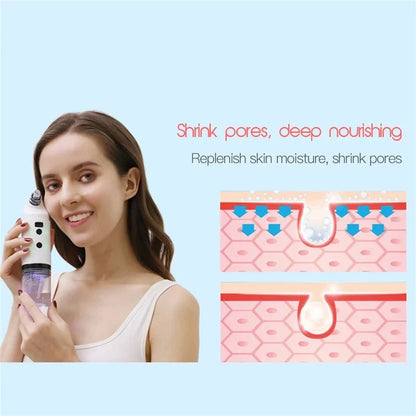 Electric Facial Cleaning Vacuum with multiple heads for deep skin cleansing and light therapy