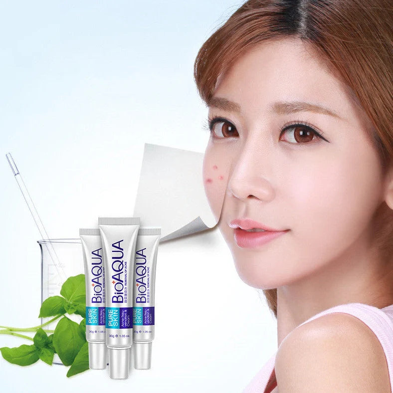 30g anti acne cream container for facial treatment targeting acne, oil control, and pores