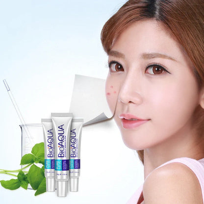 30g anti acne cream container for facial treatment targeting acne, oil control, and pores