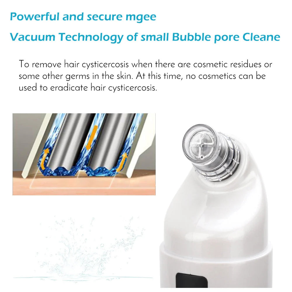 Electric Facial Cleaning Vacuum with multiple heads for deep skin cleansing and light therapy