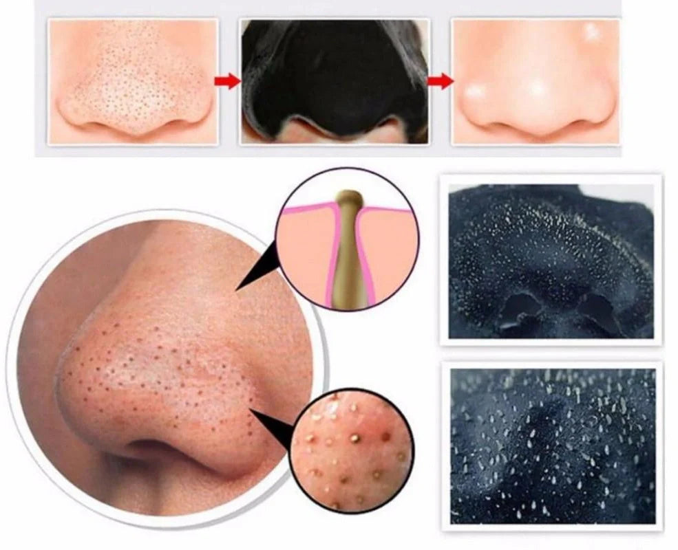 Deep cleansing black mask applied to nose for blackhead removal from pores