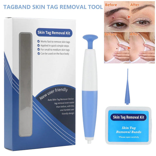 Skin Tag Removal Pen - Safe, Painless and Effective Home Treatment for Removing Moles, Warts, and Skin Tags