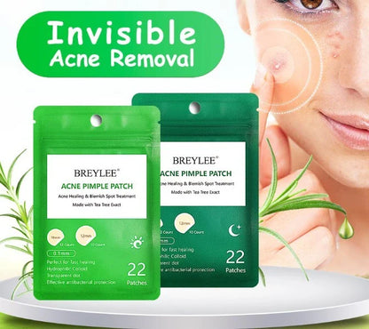 Tea Tree Acne Patch ultra-thin design for fading acne marks and blemishes