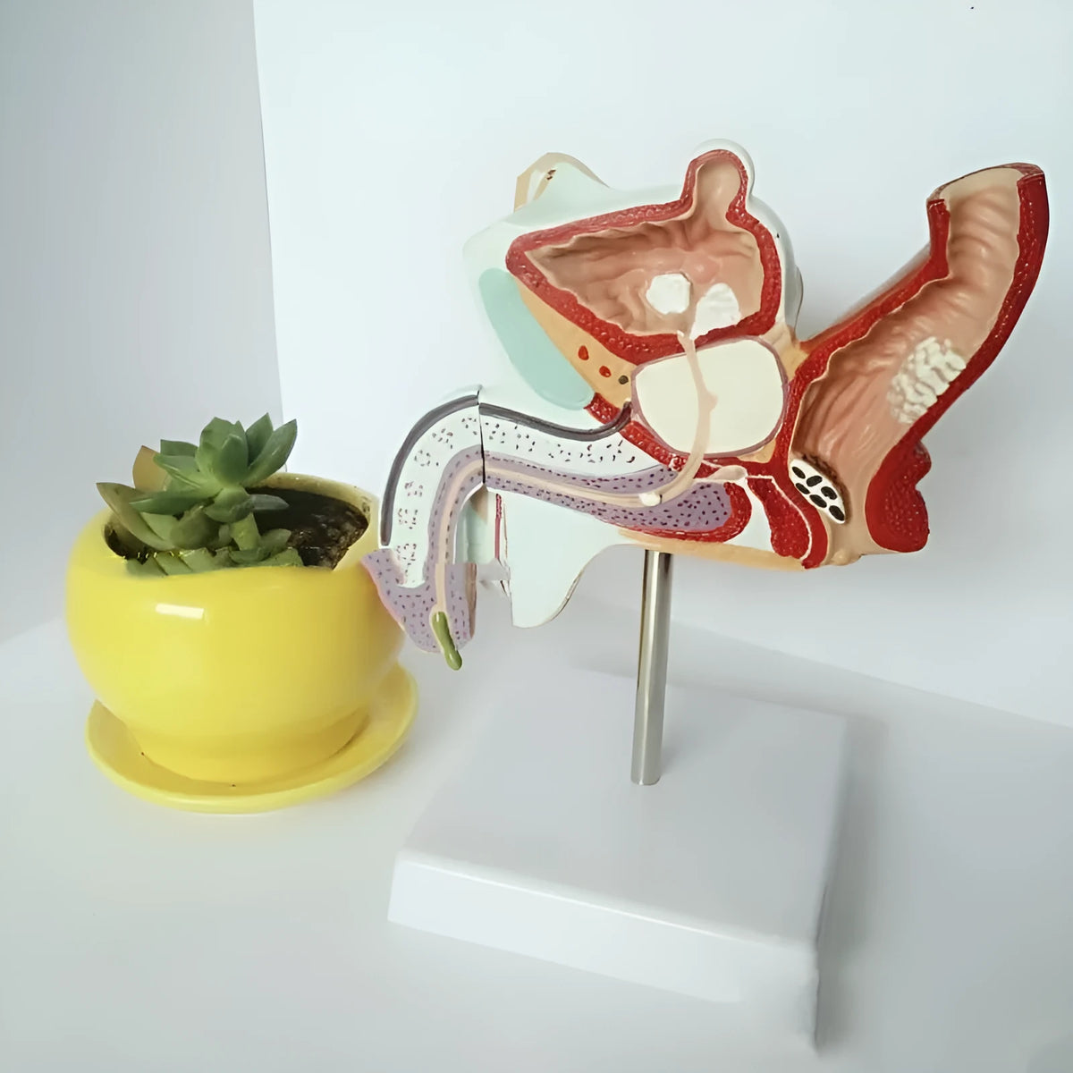 Plastic anatomical model of male reproductive system showing internal diseases on a 25.5x18x15cm base.