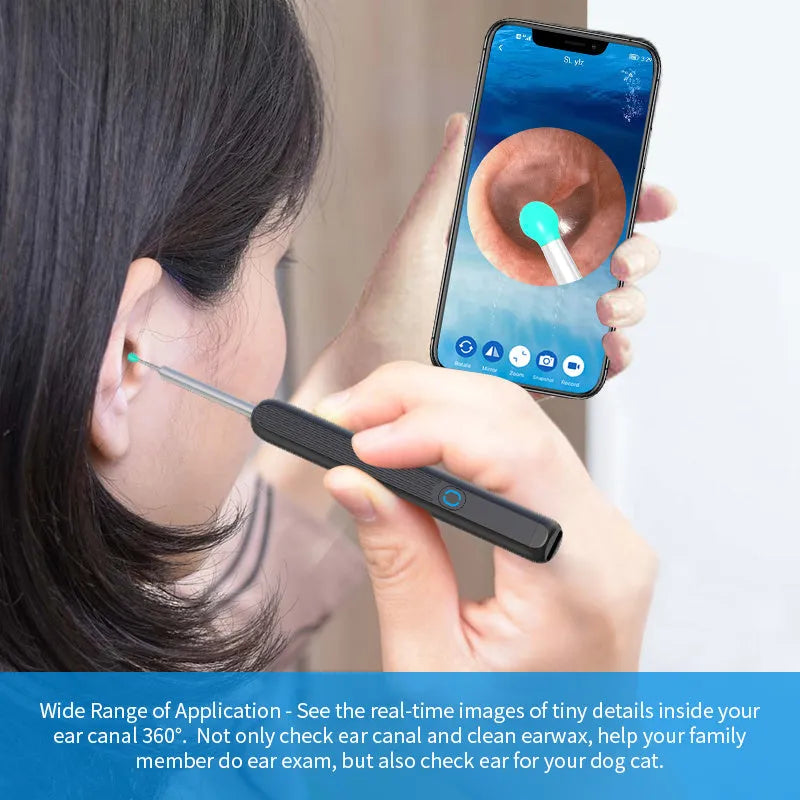 Natfire NE3 wireless otoscope ear cleaner with camera, charging cable, and spoon heads on a white background.