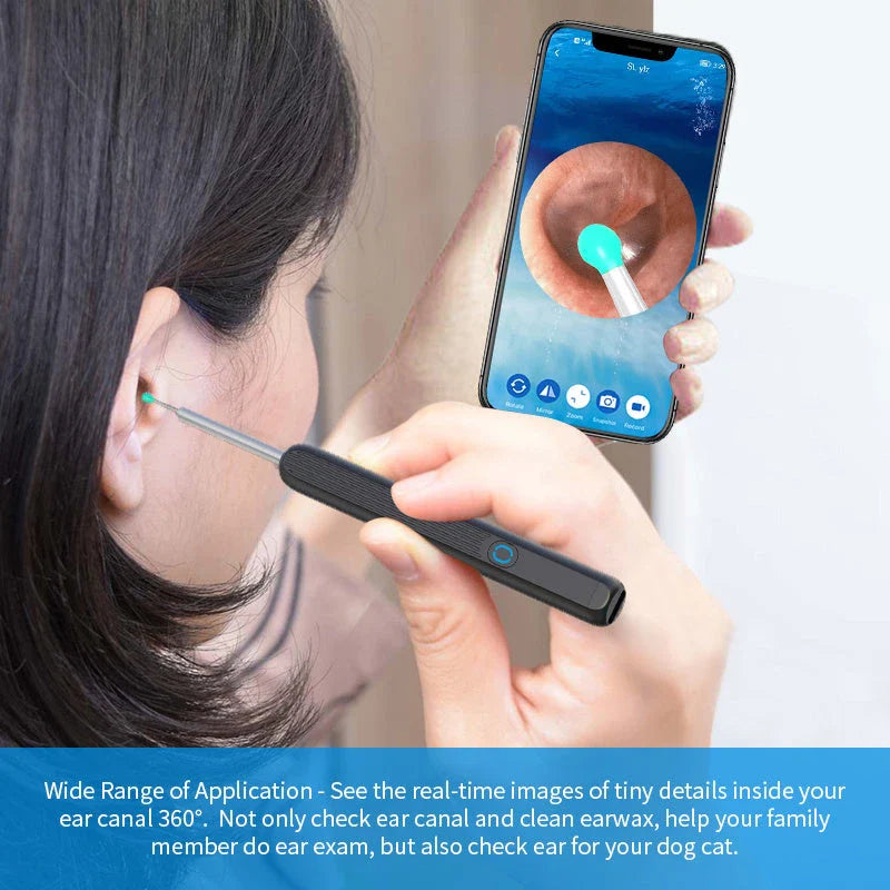 Wireless otoscope with 360-degree wide-angle lens and 1296P HD camera for comprehensive ear examination and earwax removal