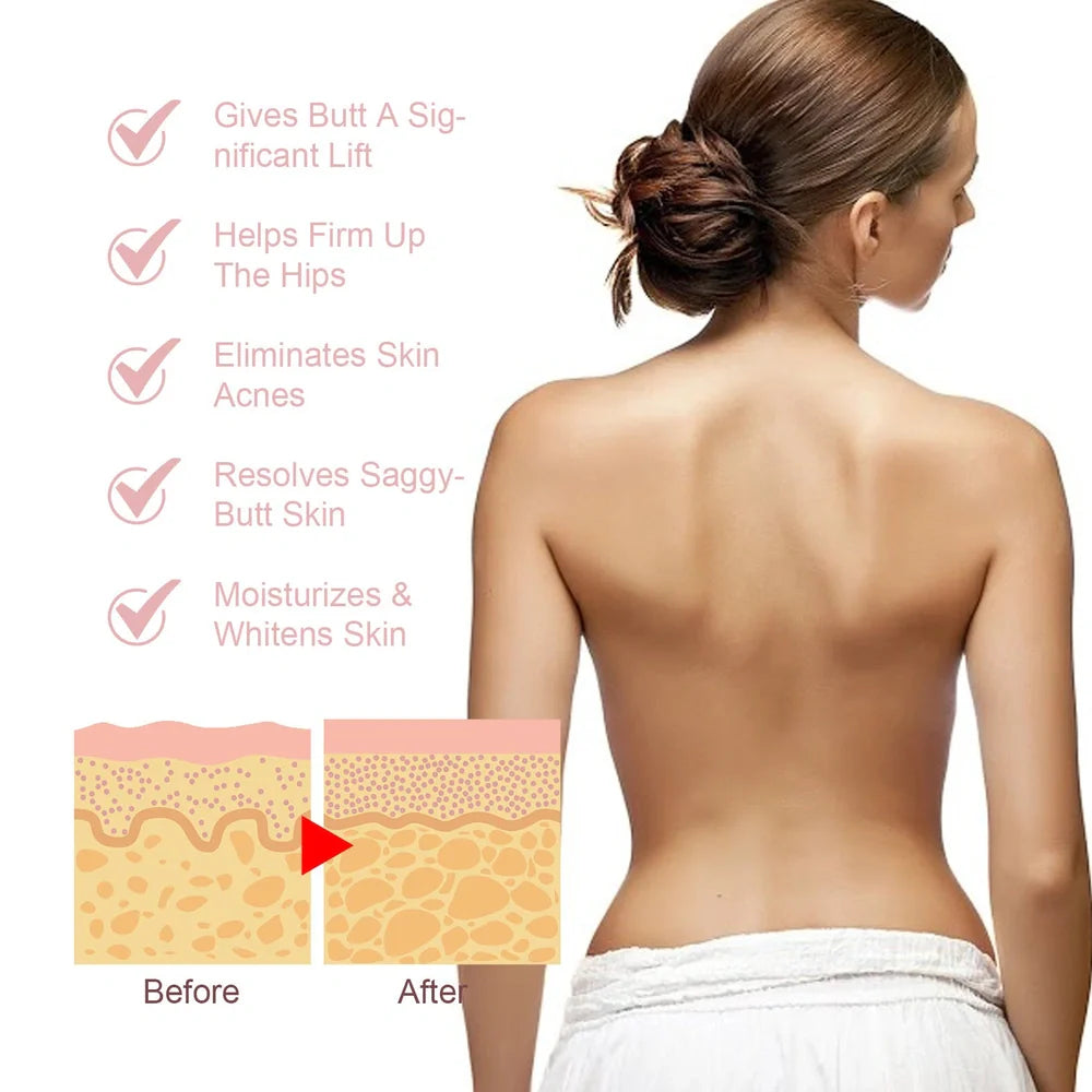 Acne Ball 30ml treatment with 13.3cm applicator for back and chest acne