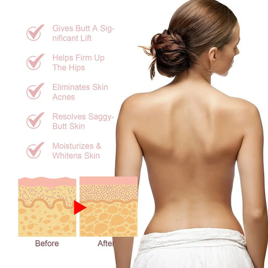 Acne Ball 30ml treatment with 13.3cm applicator for back and chest acne