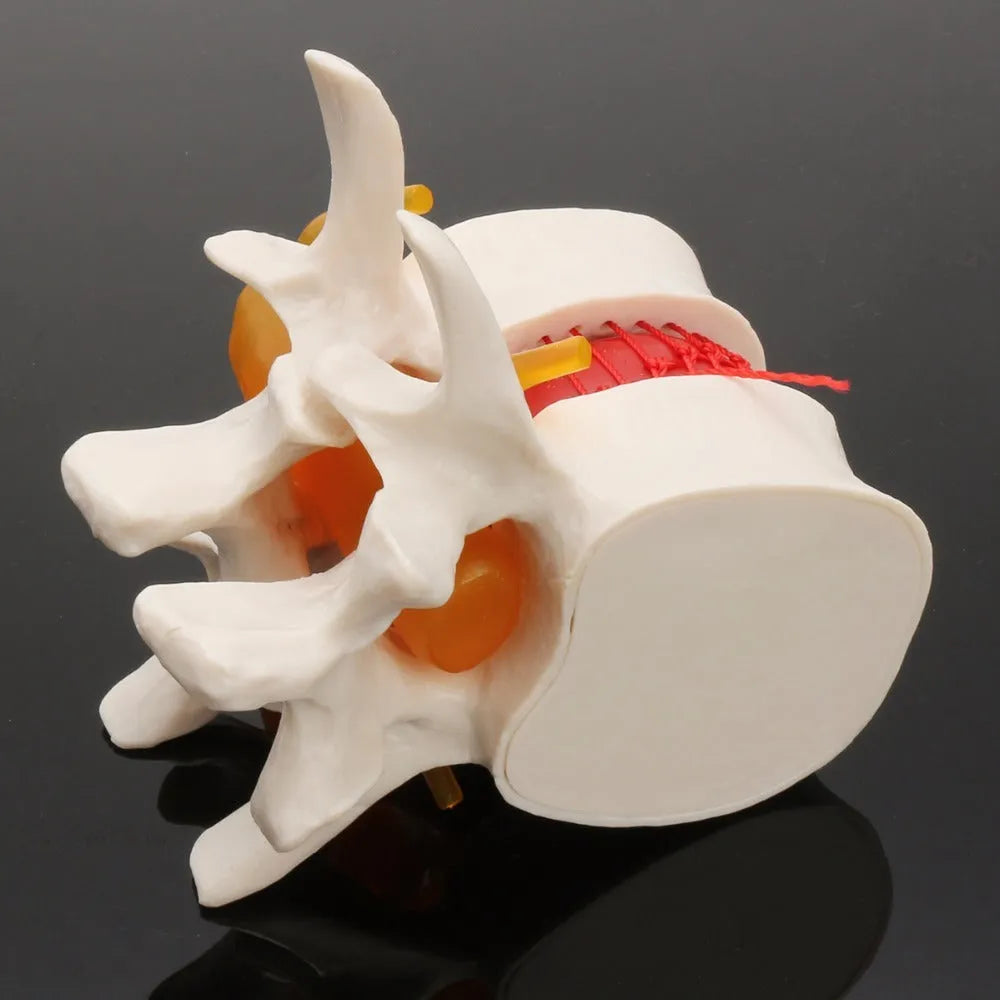 White PVC lumbar intervertebral disc demonstration model for medical education
