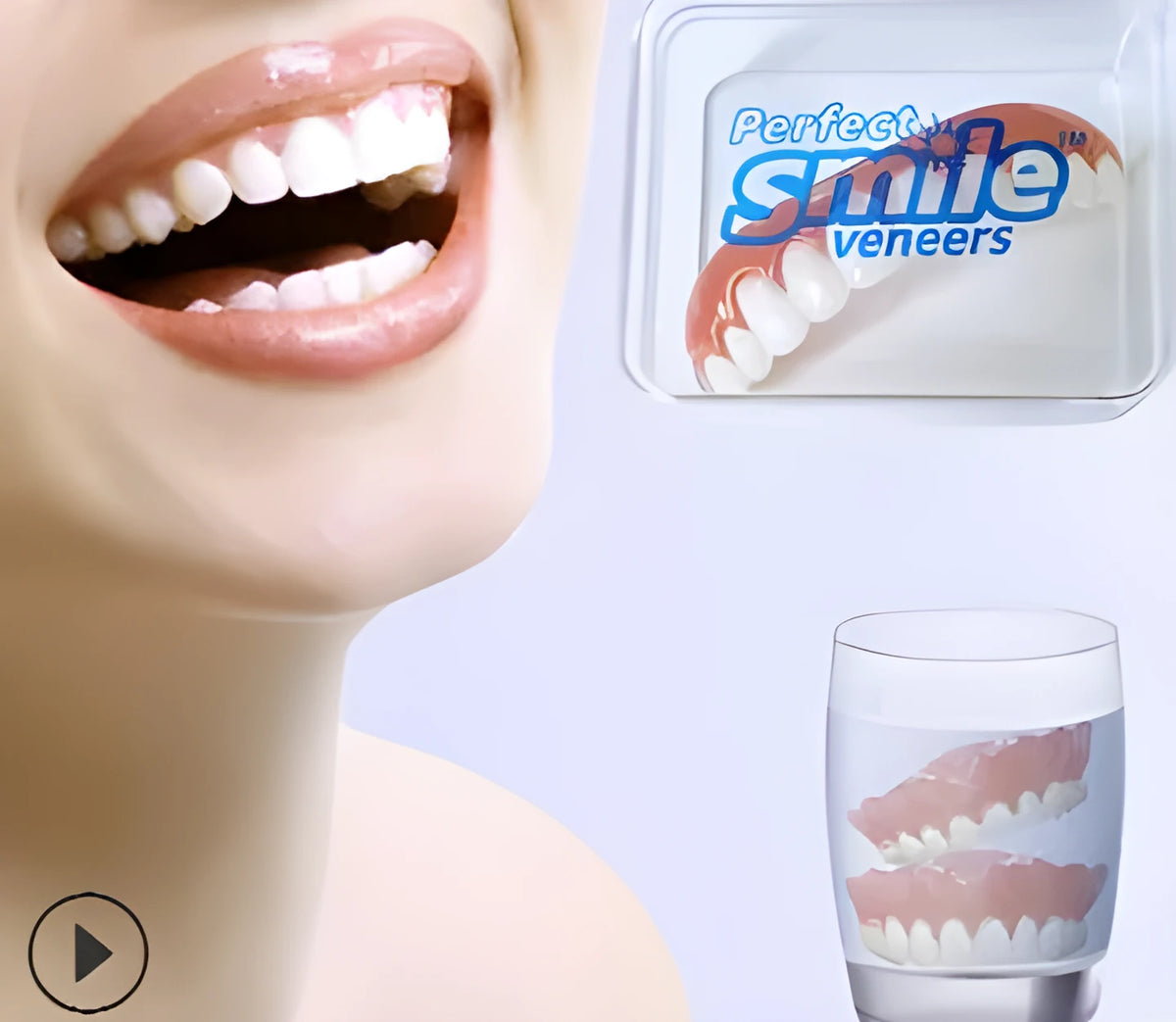 Professional smile veneers for bad teeth correction with press-on fit and compact carrying case