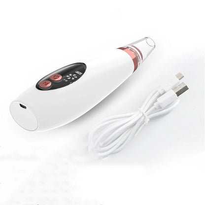 Microcrystalline Blackhead Remover with adjustable suction power for gentle skincare