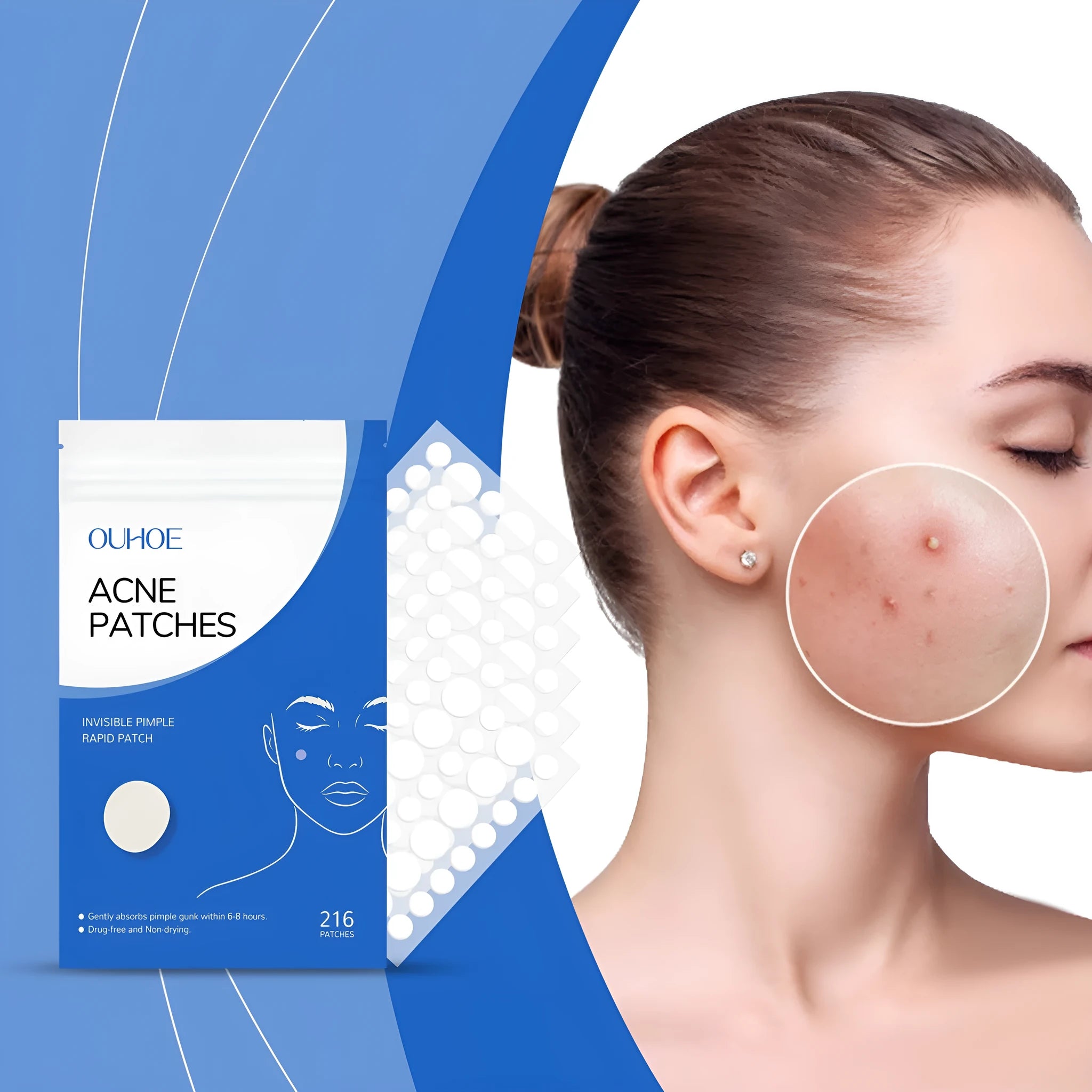 216 individually sealed hydrocolloid acne patches with tea tree oil and vitamin E