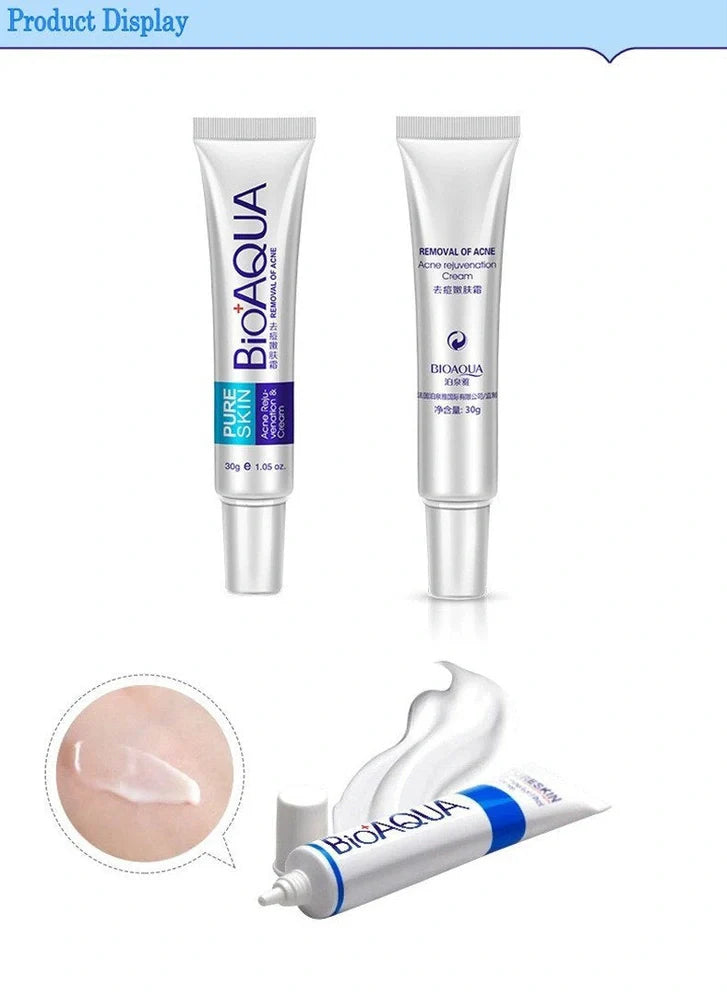 30g anti acne cream container for facial treatment targeting acne, oil control, and pores