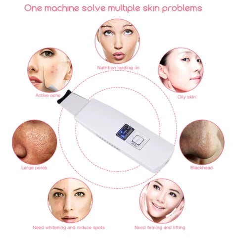 Ultrasonic Skin Scrubber for deep facial cleansing and acne removal