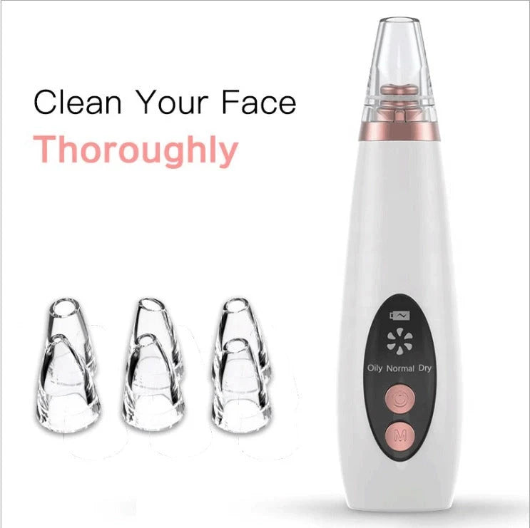 Microcrystalline Blackhead Remover with adjustable suction power for gentle skincare