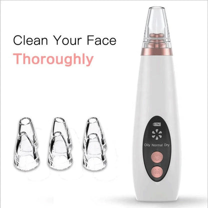 Microcrystalline Blackhead Remover with adjustable suction power for gentle skincare