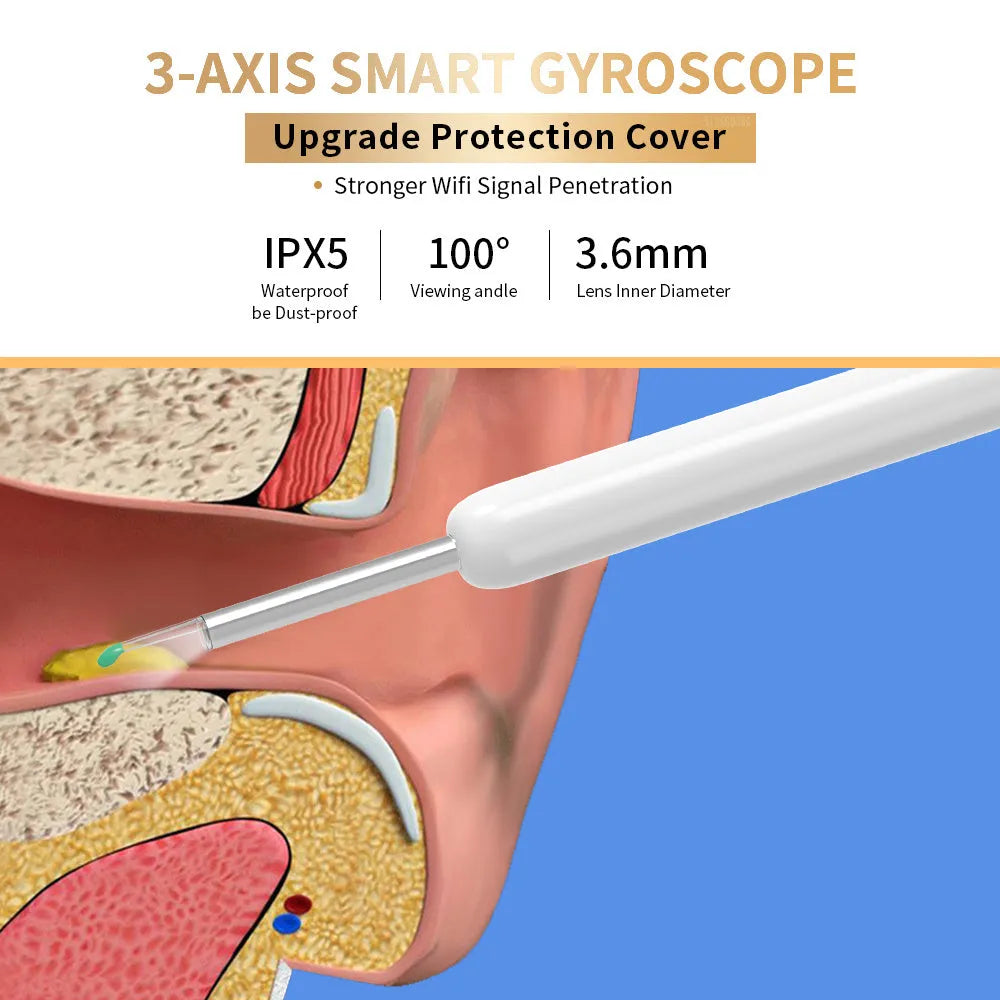 Natfire NE3 wireless otoscope ear cleaner with camera, charging cable, and spoon heads on a white background.