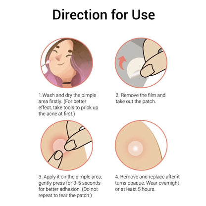 Tea Tree Acne Patch ultra-thin design for fading acne marks and blemishes