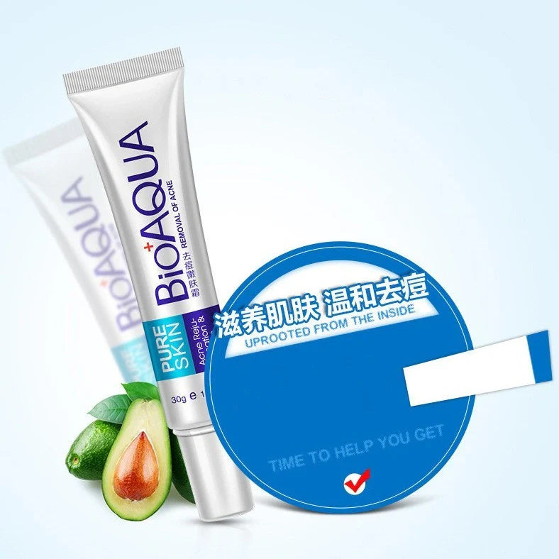 30g anti acne cream container for facial treatment targeting acne, oil control, and pores