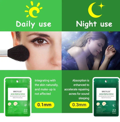 Tea Tree Acne Patch ultra-thin design for fading acne marks and blemishes
