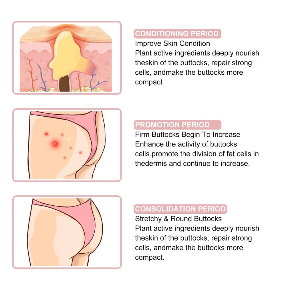 Acne Ball 30ml treatment with 13.3cm applicator for back and chest acne