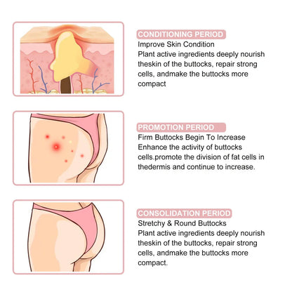 Acne Ball 30ml treatment with 13.3cm applicator for back and chest acne