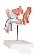 Plastic anatomical model of male reproductive system showing internal diseases on a 25.5x18x15cm base.