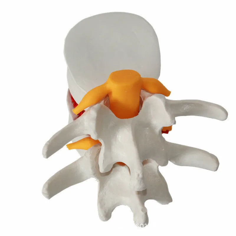 White PVC lumbar intervertebral disc demonstration model for medical education