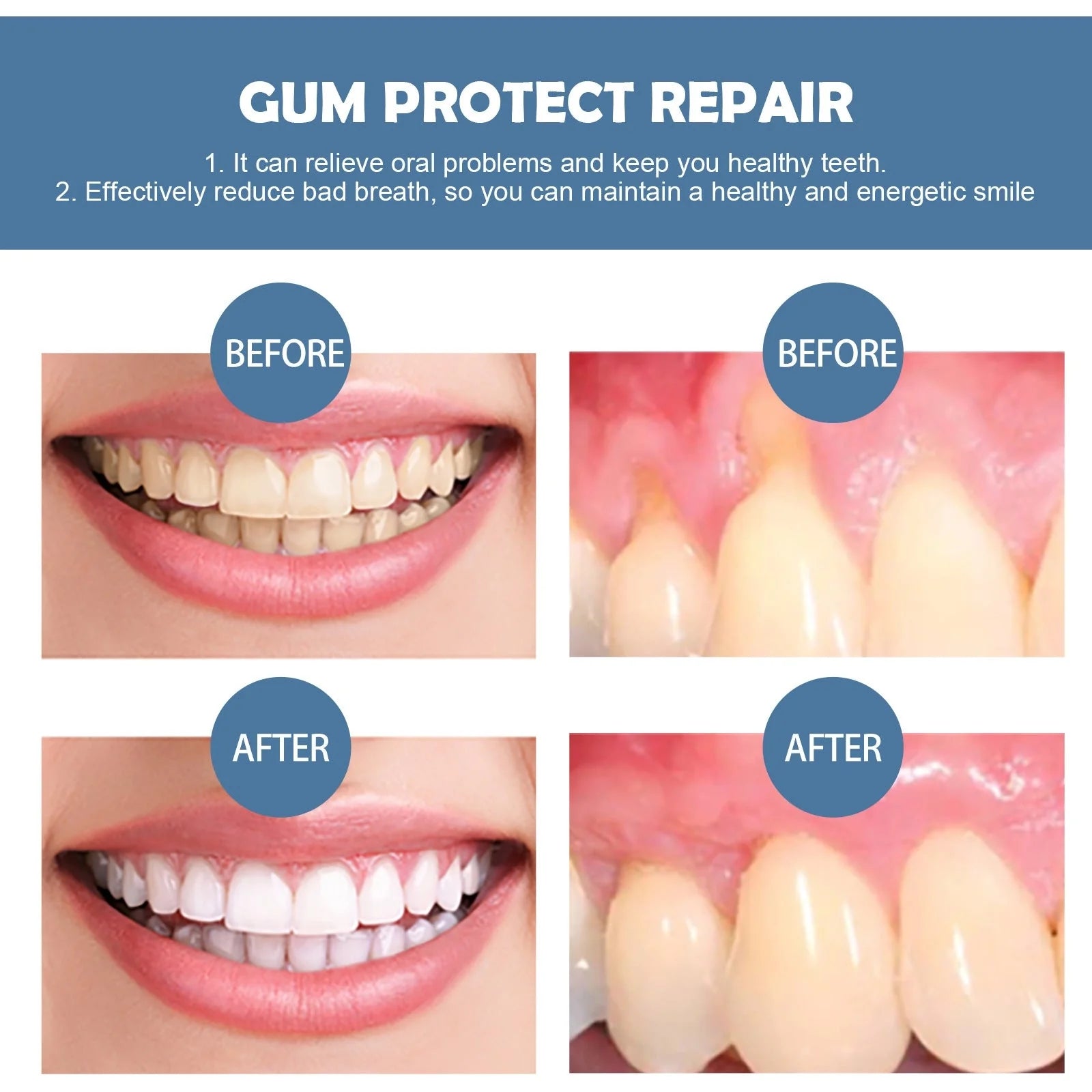 Gum Repair Series products: Drops, Essence, and Spray for natural tooth stain removal and gum care