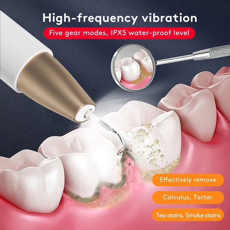 Gold ultrasonic tooth cleaner for tartar removal and stain cleaning