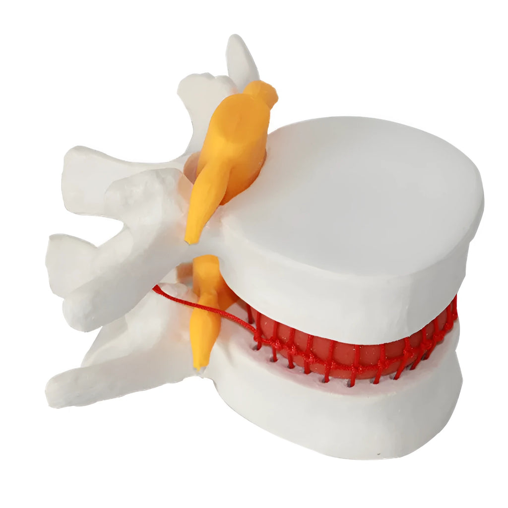 White PVC lumbar intervertebral disc demonstration model for medical education