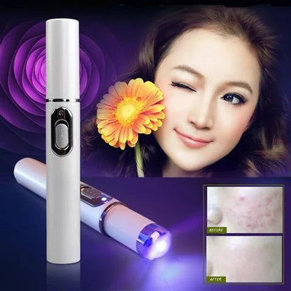 Blue Light Therapy Pen for treating acne, scars, and wrinkles with precise blue light, warming, and microcurrent technology