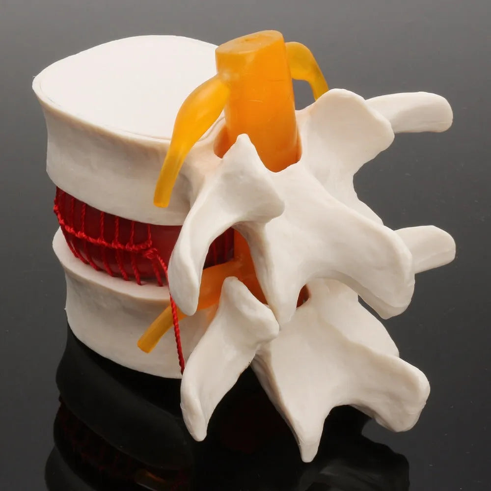White PVC lumbar intervertebral disc demonstration model for medical education