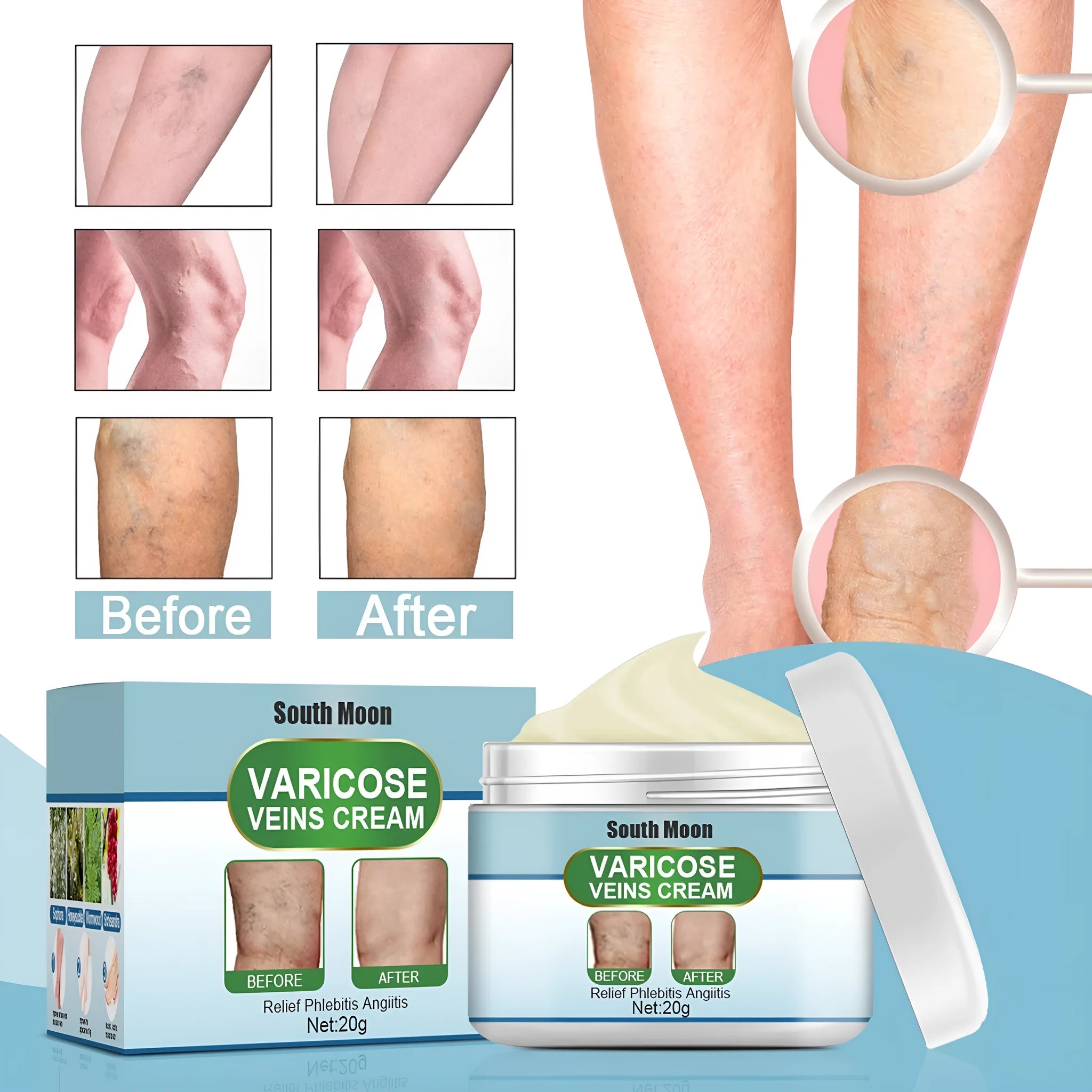 20g tube of vein repair cream for varicose and spider veins on legs