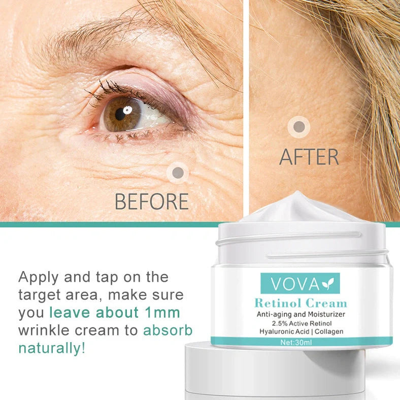 30ml collagen hyaluronic acid anti-wrinkle cream container showing 30g net content