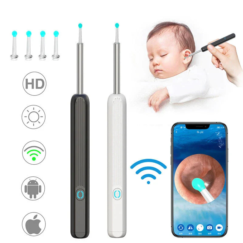 Wireless otoscope with 360-degree wide-angle lens and 1296P HD camera for comprehensive ear examination and earwax removal