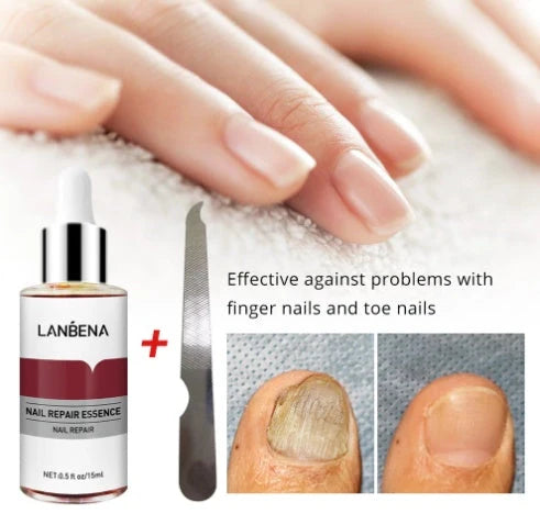 Nail Repair and Care Essence bottle with salicylic acid and natural extracts