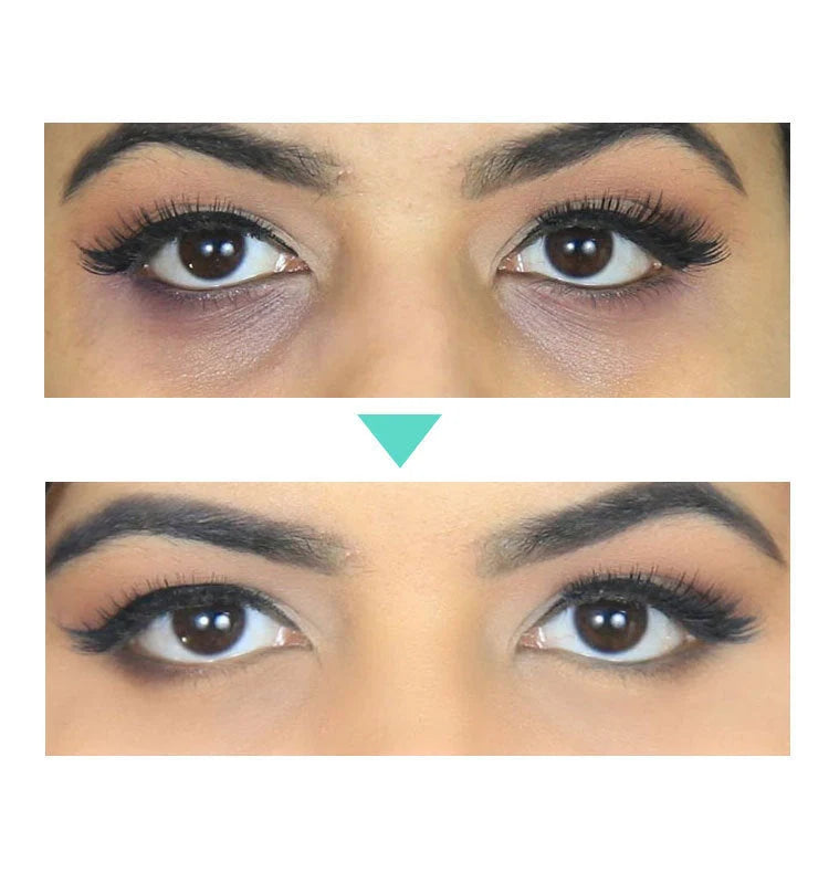 30ml Beauty Eye Cream for Women - Reduces puffiness and dark circles