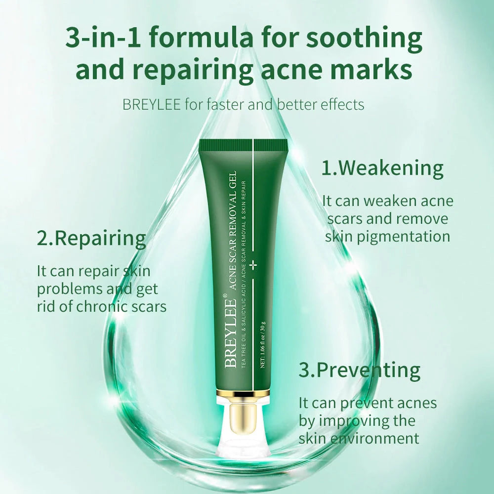Tea Tree Acne Scar Removal Gel with Qu Dou Printing, 30g tube