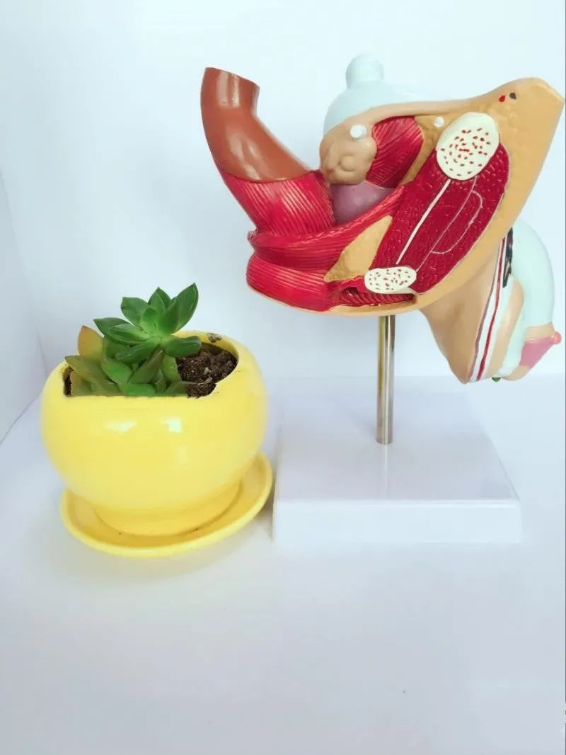 Plastic anatomical model of male reproductive system showing internal diseases on a 25.5x18x15cm base.