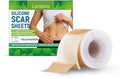 One roll of clear silicone scar sheet showing measurements of 4 cm wide by 150 cm long.