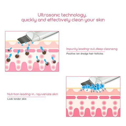 Ultrasonic Skin Scrubber for deep facial cleansing and acne removal