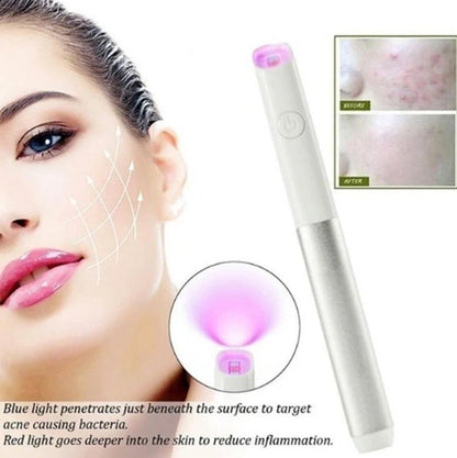 Silver grey acne treatment device with red and blue light therapy, battery-powered design