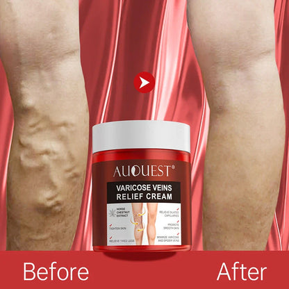 80g Chinese herbal venous cream for leg blood vessel care with three-year shelf life