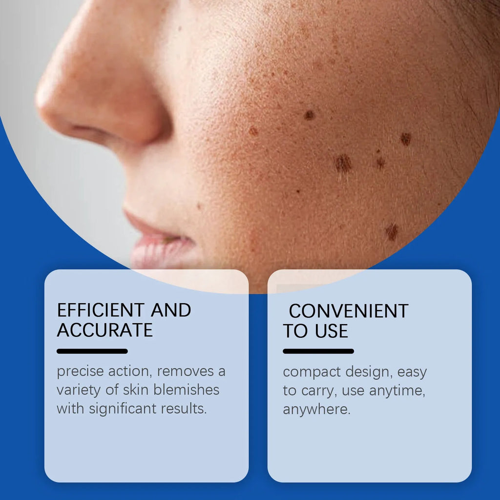 White mole wart removal laser pen with ABS plastic construction for cosmetic skin treatment
