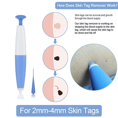 Skin Tag Removal Pen - Safe, Painless and Effective Home Treatment for Removing Moles, Warts, and Skin Tags